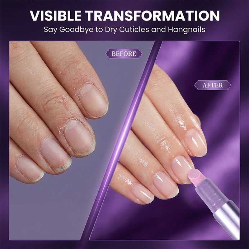 Nail serum pen