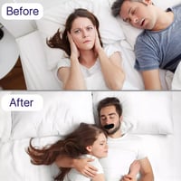 Anti-Snoring Mouth Tape