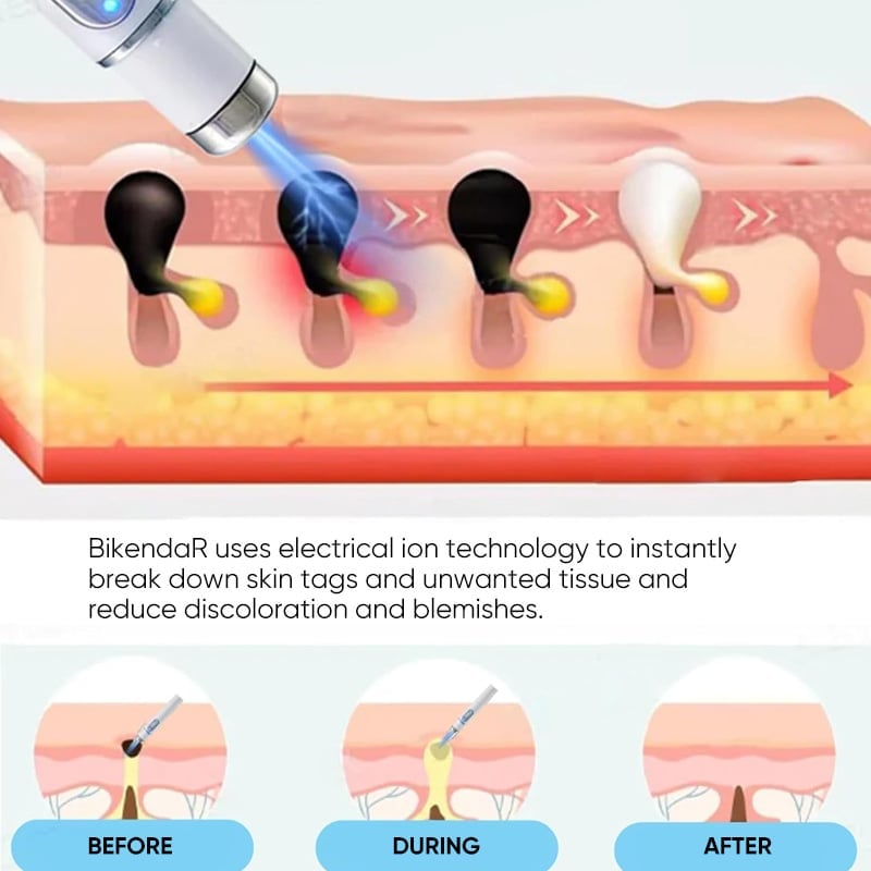 Traceless Freckle Removal Laser Mole Removal Beauty Instrument