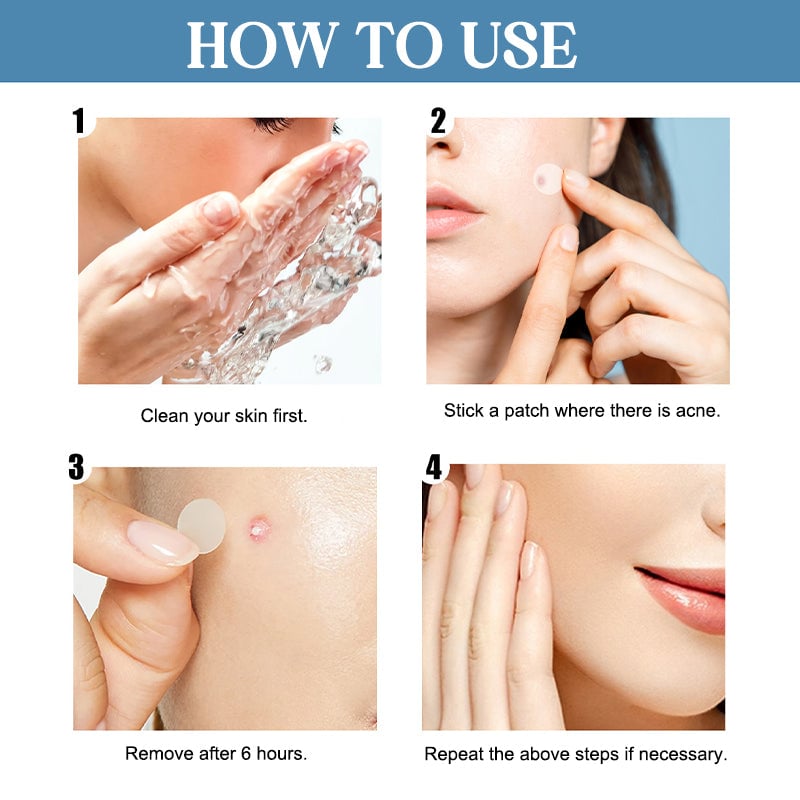 💕Acne Patches💕