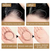 🧴🪮Anti-Hair Fall Hair Loss Shampoo