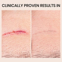 Gentle Silicone Scar Stick – Nourishing & Smoothing Balm for Facial Skin