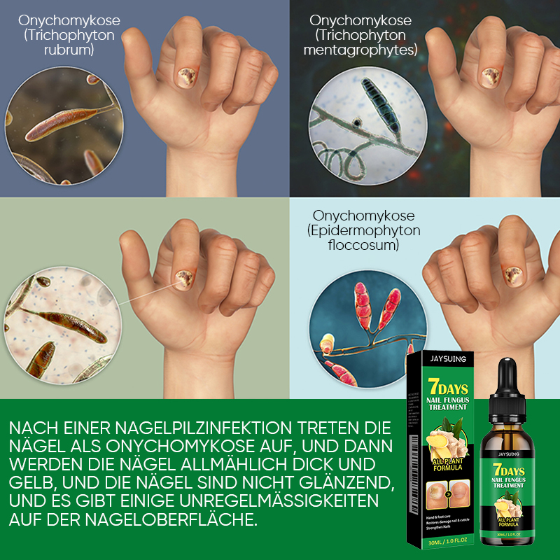 Ingwer-Nagelbehandlung