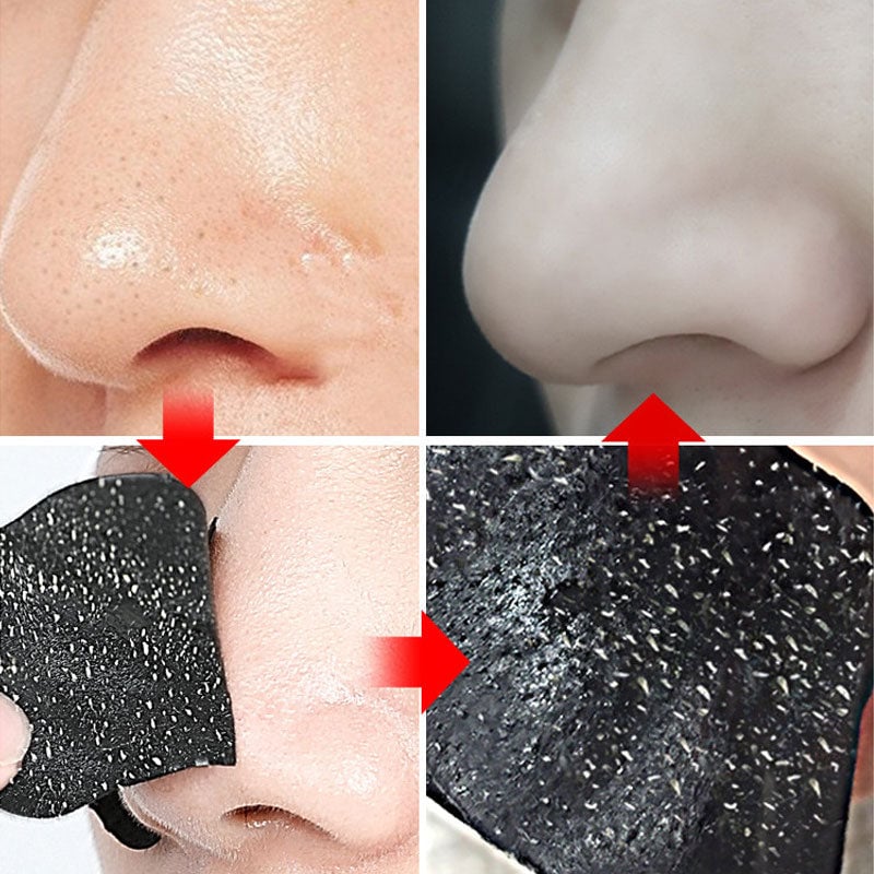 Deep-Cleansing Blackhead Nose Strips