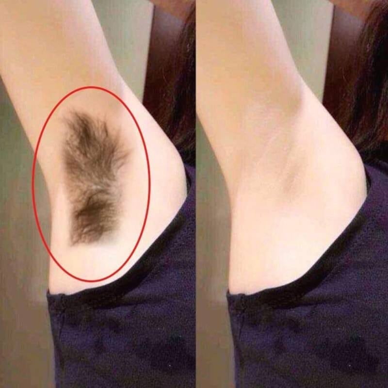 😍Powerful and Painless Hair Removal Spray😍