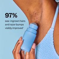 Razor Bump & Ingrown Hair Treatment