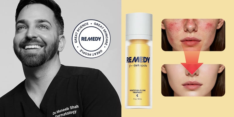 Before and after photo showing reduced redness and discoloration on a woman's cheek