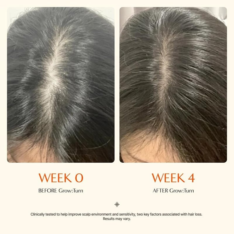Hair Growth Serum with Massage Brush