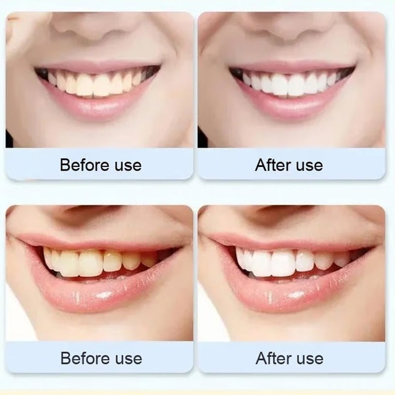 Super Probiotic-6 Toothpaste🔥buy 2 get1 free🔥