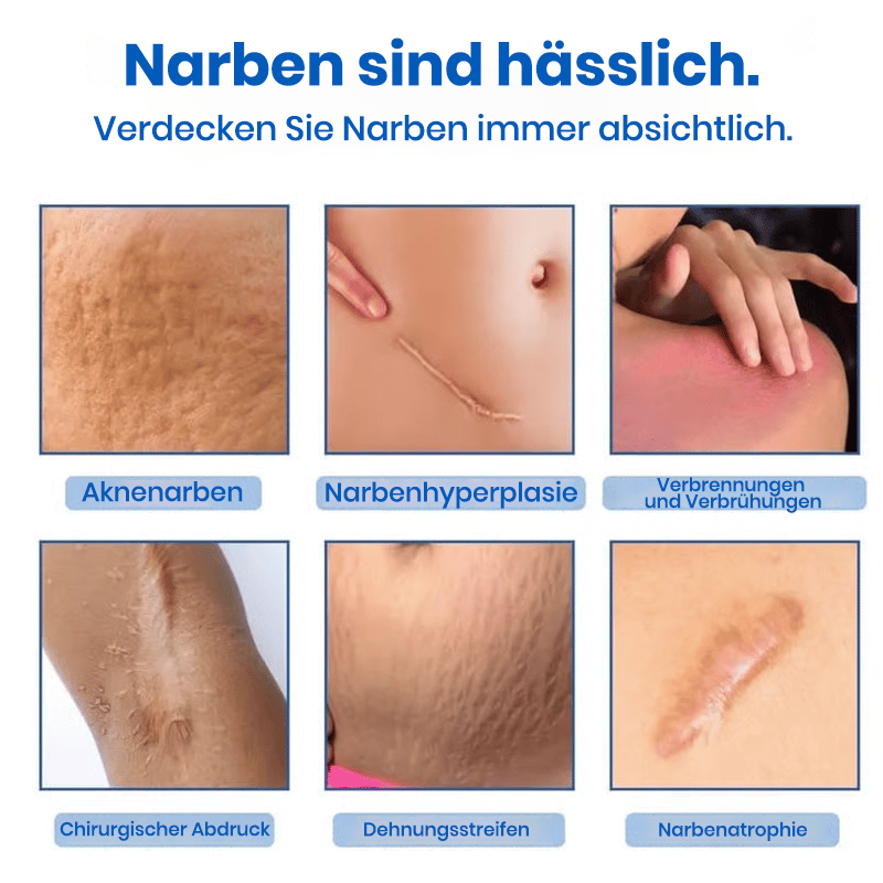 Professionelles Gel zur Narbenentfernung