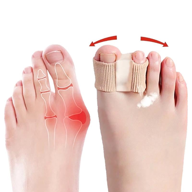 Bequeme Hallux-Valgus-Korrektur
