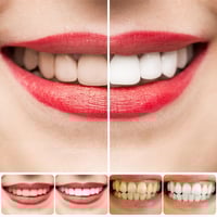 SP-8/SP-10 Probiotische Whitening-Zahnpasta für die Mundgesundheit