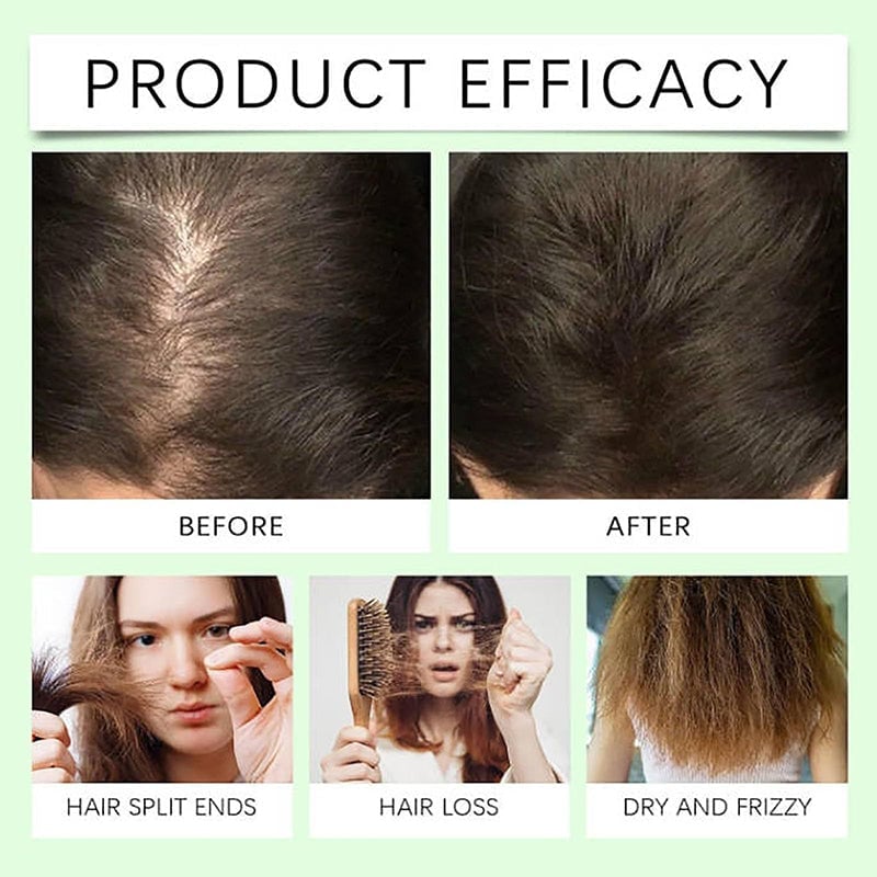 🧴🪮Anti-Hair Fall Hair Loss Shampoo