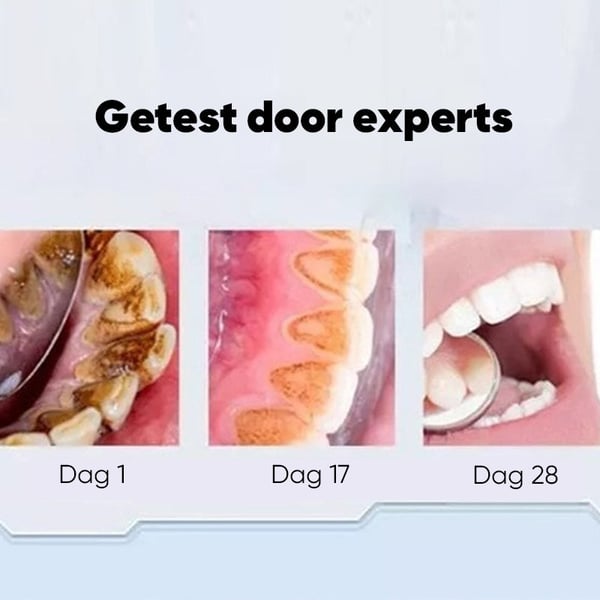 Super Probiotic-6 Tandpasta