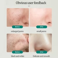 🎁55% OFF🎁Southern Xiehe Niacinamide Whitening Facial Cleanser