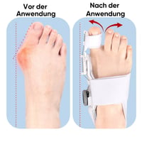 Verbesserter Ballenzehen-Korrektor