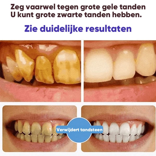 Super Probiotic-6 Tandpasta