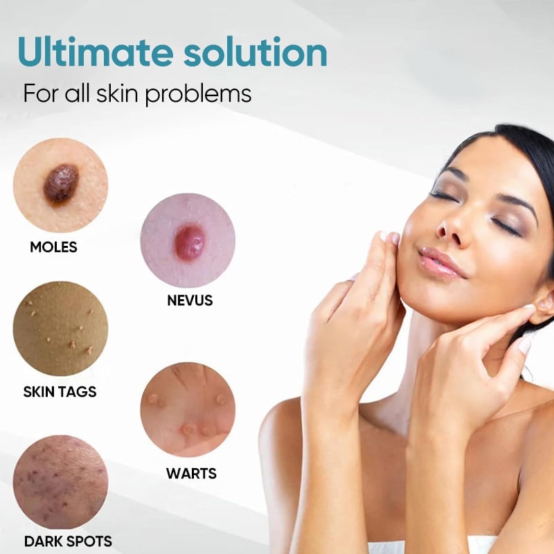 Traceless Freckle Removal Laser Mole Removal Beauty Instrument