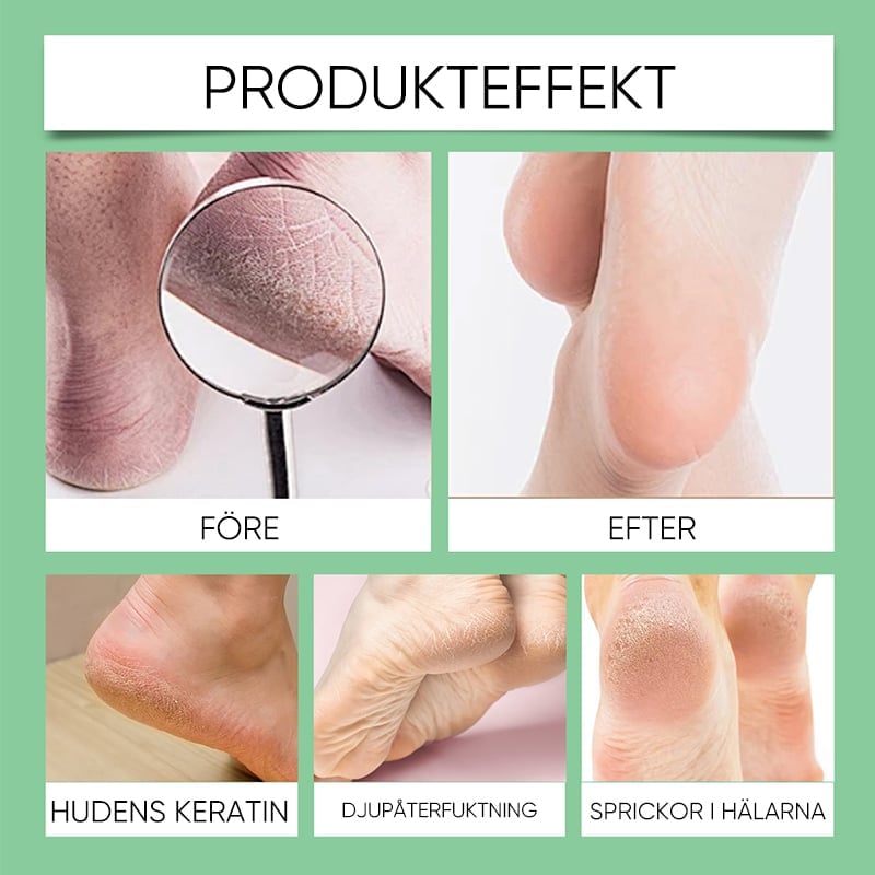 Förhårdnadsborttagare för fötter