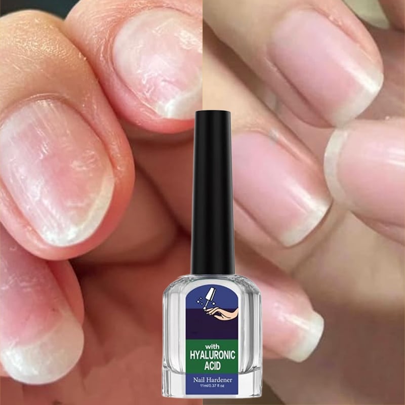 Lösning för svampdödande nagelreparation