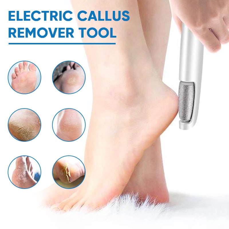 Sale - Electric Feet Callus Remover