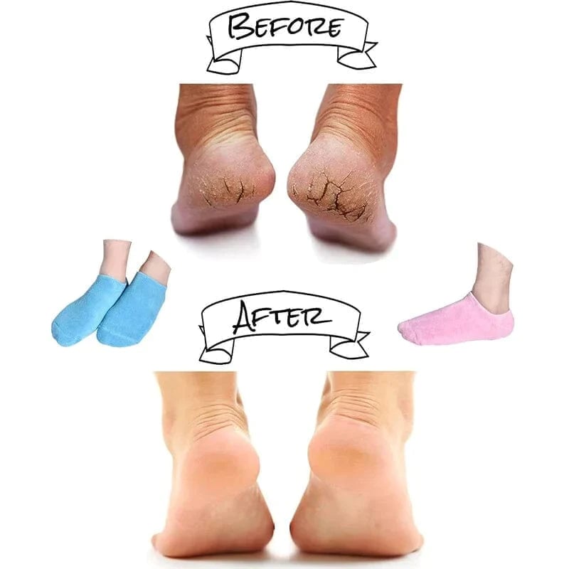 Moisturizing Socks with Spa Gel Lining
