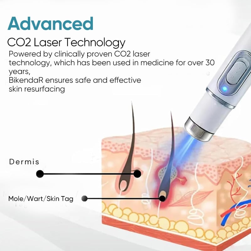Traceless Freckle Removal Laser Mole Removal Beauty Instrument