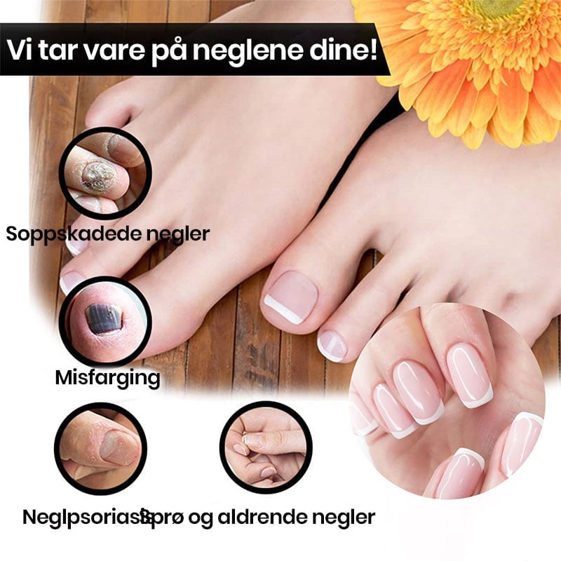 Løsning for Neglefornyelse