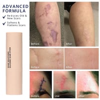 Gentle Silicone Scar Stick – Nourishing & Smoothing Balm for Facial Skin