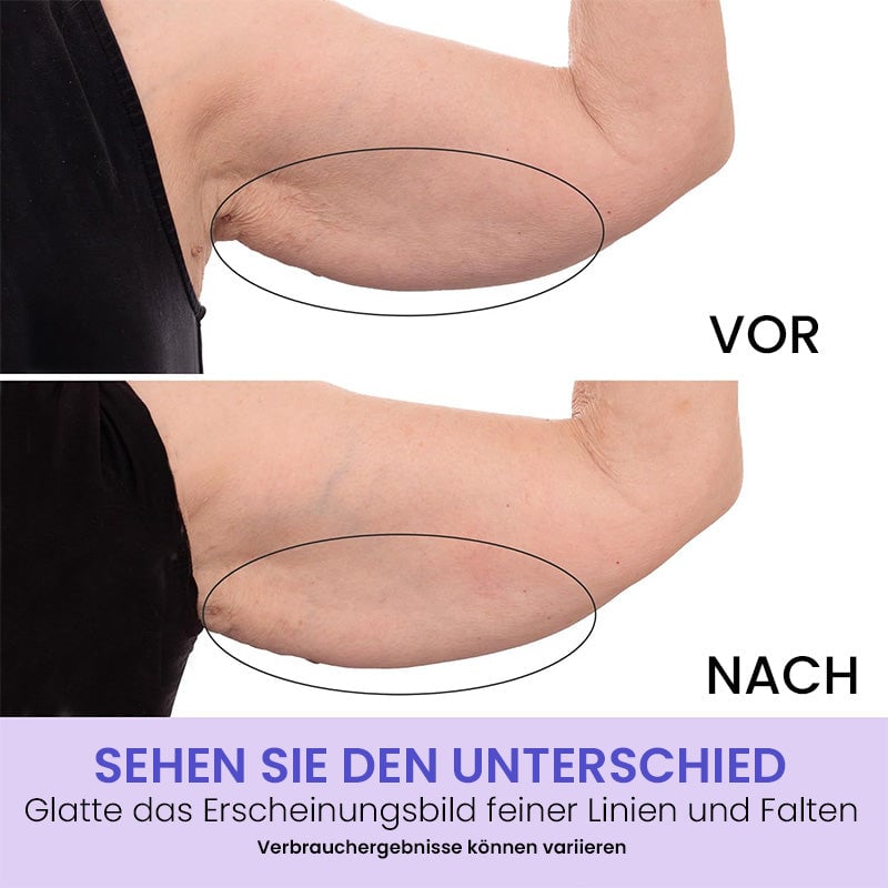 Arm-Creme zum Sculpten und Straffen💪