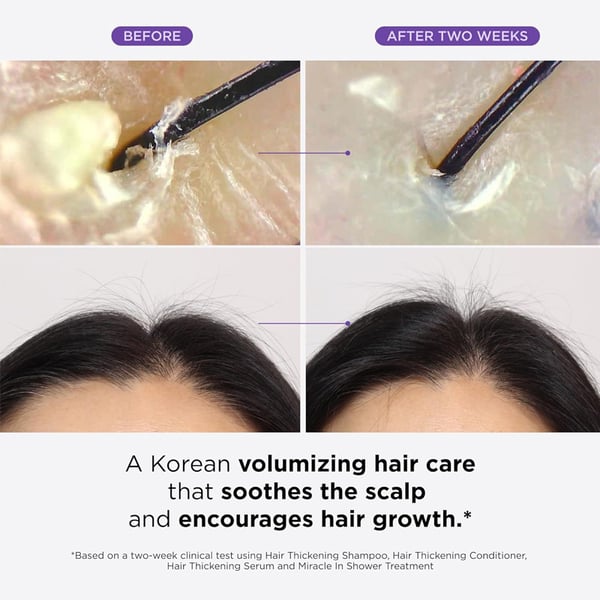 Hair Treatment Serum Roll On