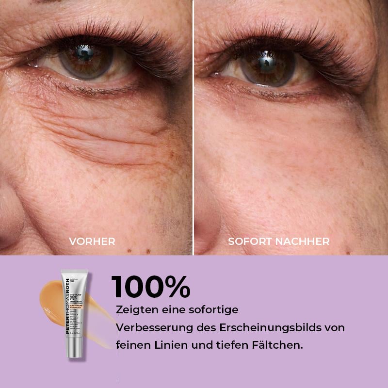 Temporärer Augenstraffer