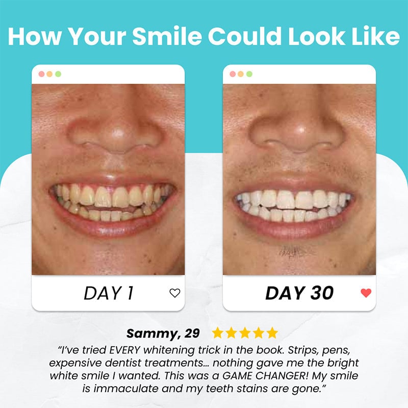 U Shaped Electric Toothbrush