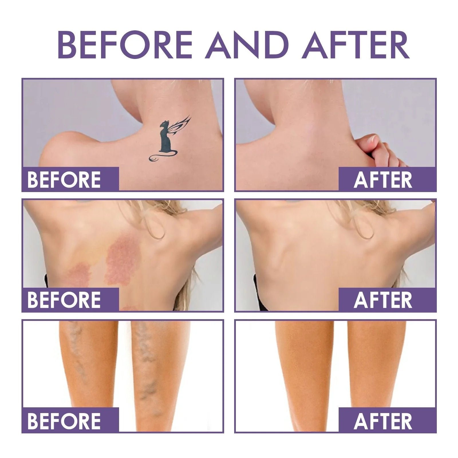 Waterproof Body Coverage Perfector【With free makeup brush】