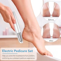 Electric Feet Callus Remover