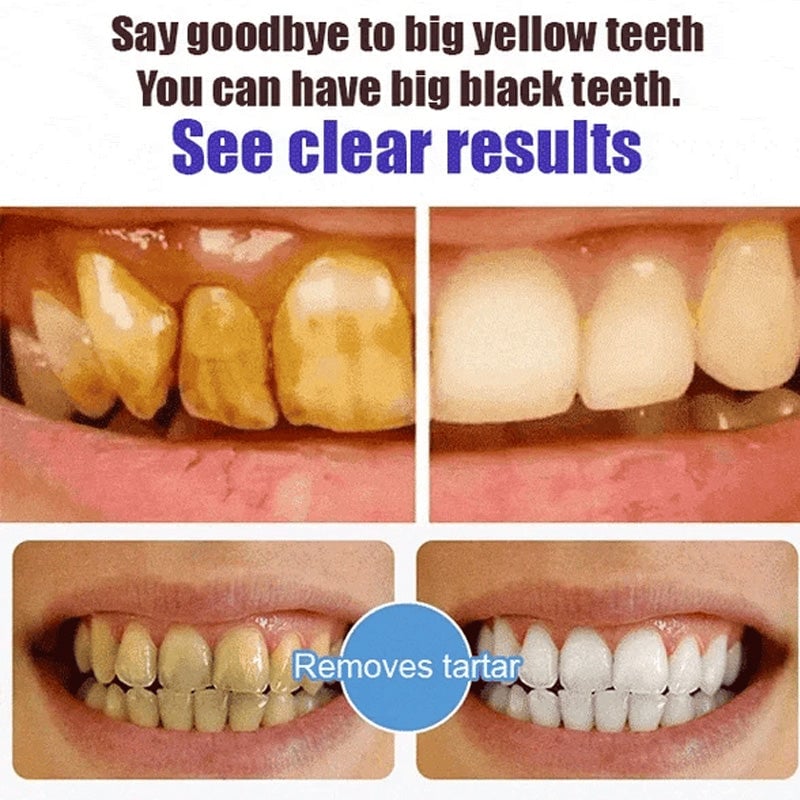 Super Probiotic-6 Toothpaste🔥buy 2 get1 free🔥