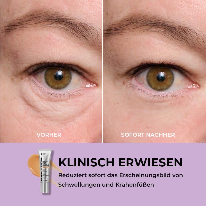 Temporärer Augenstraffer