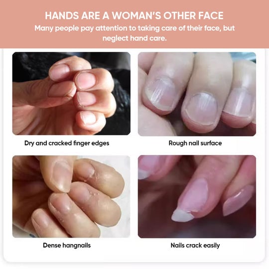 💅Hot Sale 49%OFF🔥Nails Nutritious Growth Oil