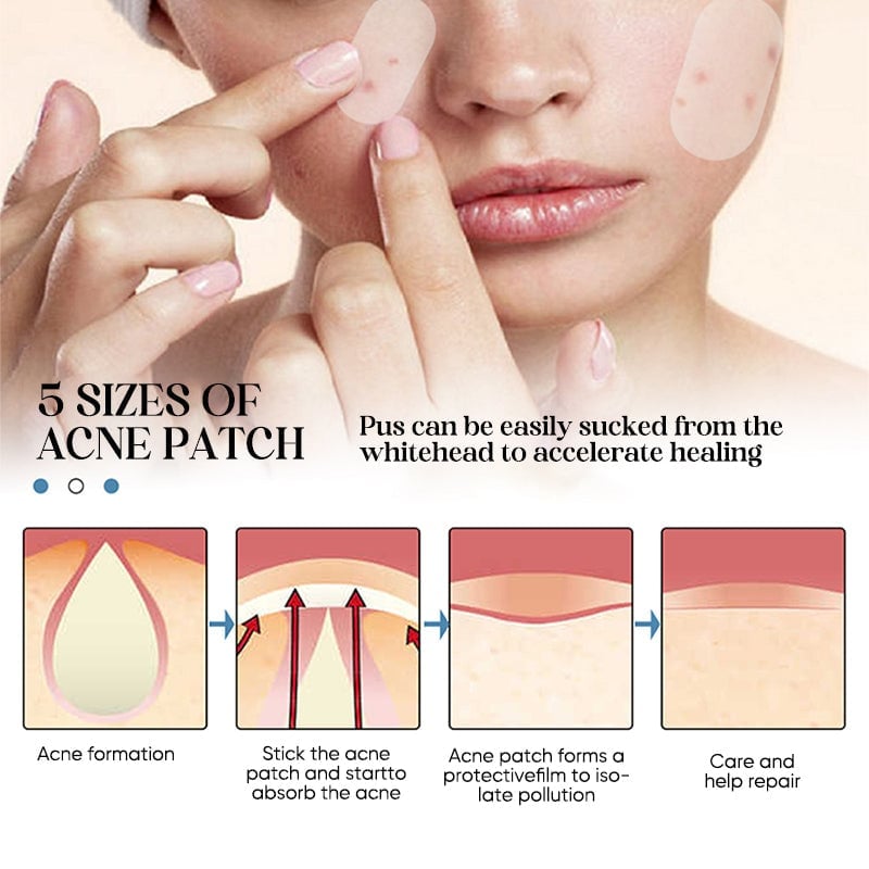 💕Acne Patches💕