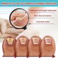 Nail Care Patches