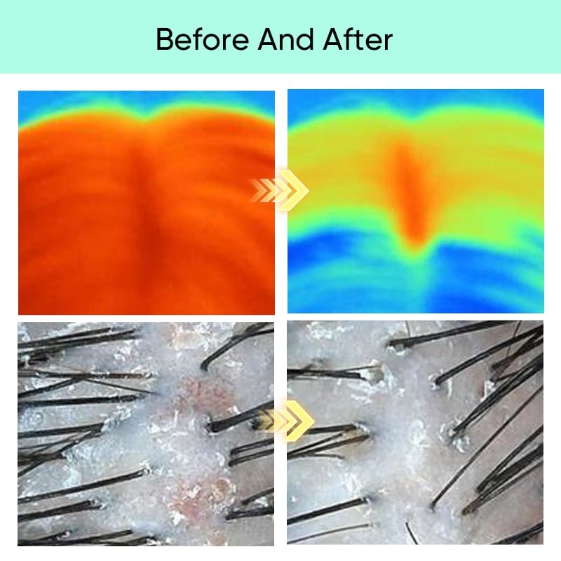 Scalp Revitalization Treatment 💡