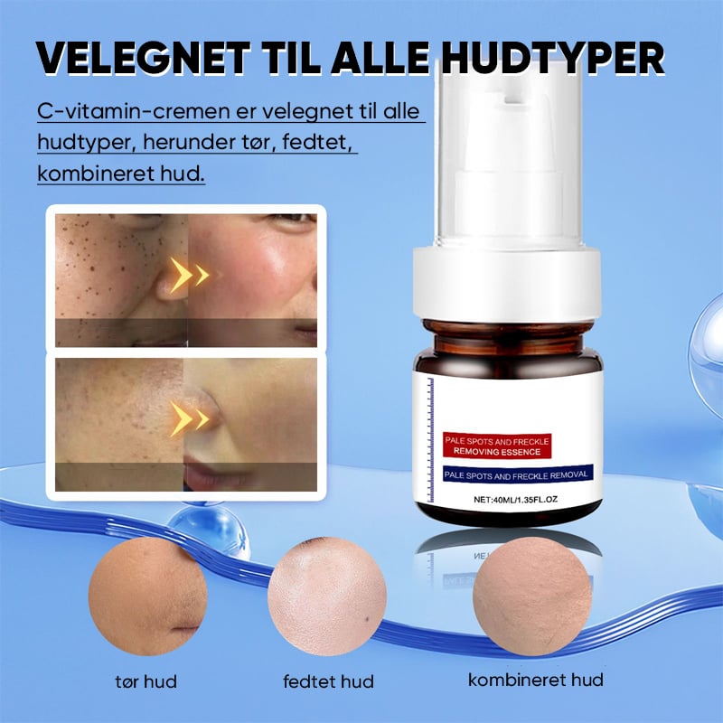 Vitamin C Whitening Freckles Face Cream