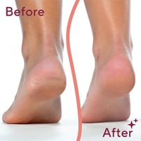 Dual Head Electric Feet Callus Remover