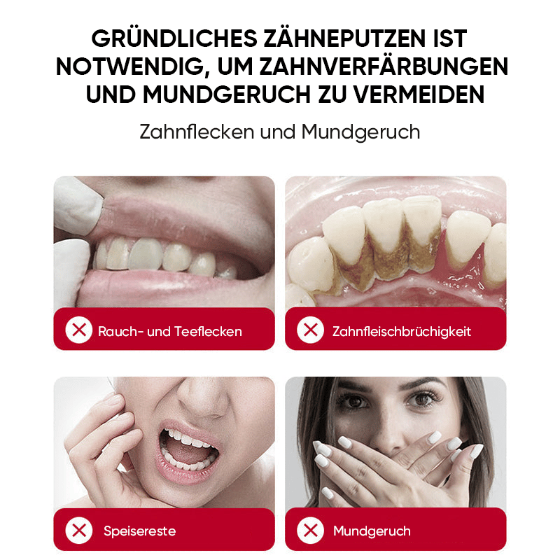 SP-8/SP-10 Probiotische Whitening-Zahnpasta für die Mundgesundheit