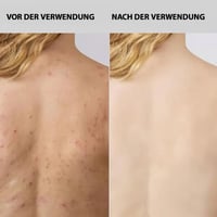 Peeling-Duschhandtuch
