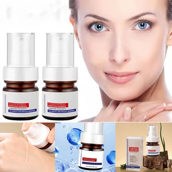 Crema facial blanqueadora de pecas con vitamina C