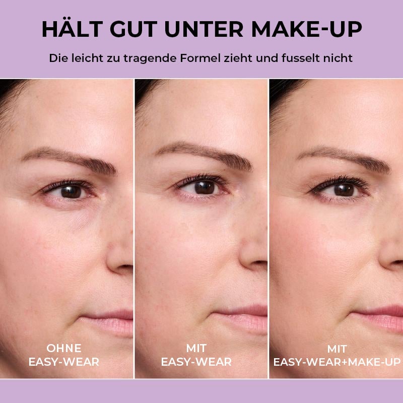 Temporärer Augenstraffer