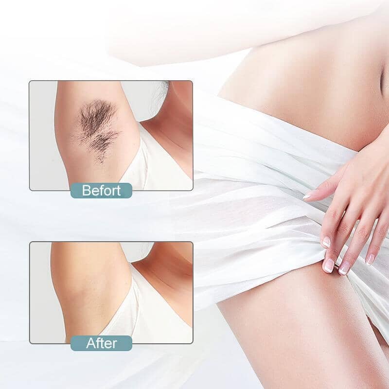 Precise & Gentle Electric Epilator