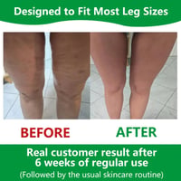 Sakerplus Cellulite Massage Roller