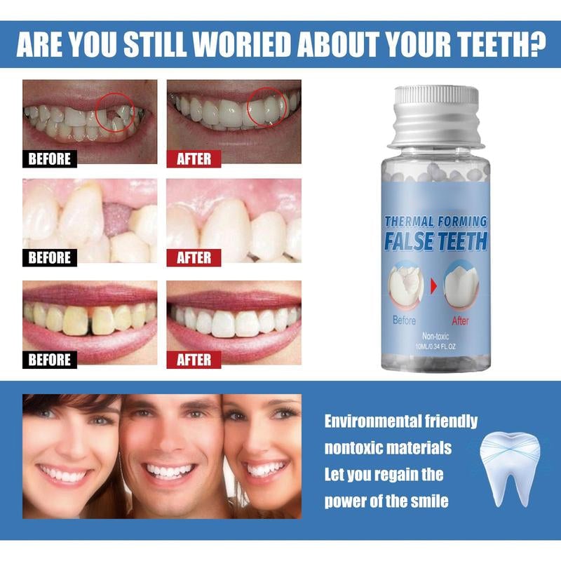 ✨ Moldable False Teeth for Temporary Tooth Fillings